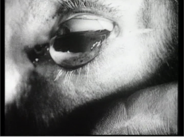 Donkey eye from <em>Un Chien Andalou</em>